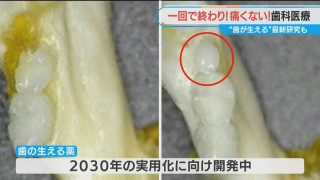 歯の詰め物治療がたった1回で完了！ 「歯が生える薬」の実用化も間近　進化する歯科治療の最前線を調査