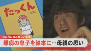 【色素性乾皮症】太陽の光でがんに…神経症状も引き起こす難病【チャント!特集】