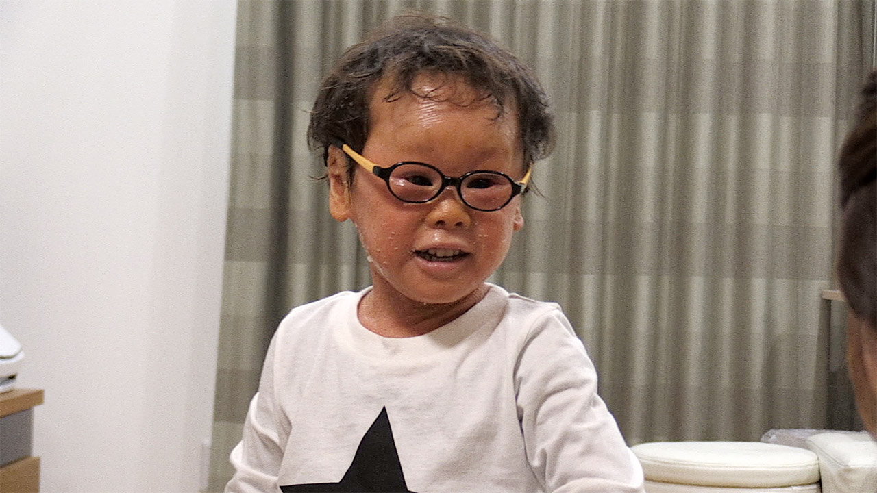 「ピエロと呼ばれた息子」～道化師様魚鱗癬との闘い～