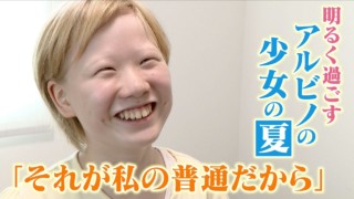 2万人に1人の “指定難病” を患う12歳少女 新たなチャレンジに密着「アルビノも悪くない」