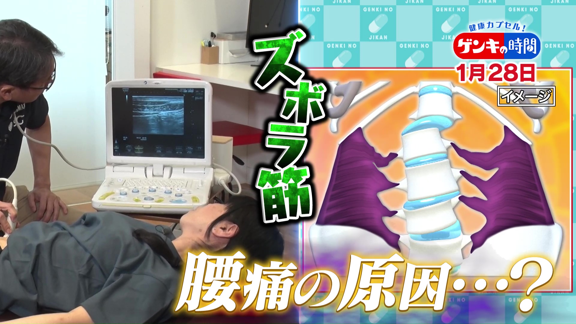 今注目「腰痛」の原因?“ズボラ筋”…腰痛予防・改善!簡単チェックとエクササイズ