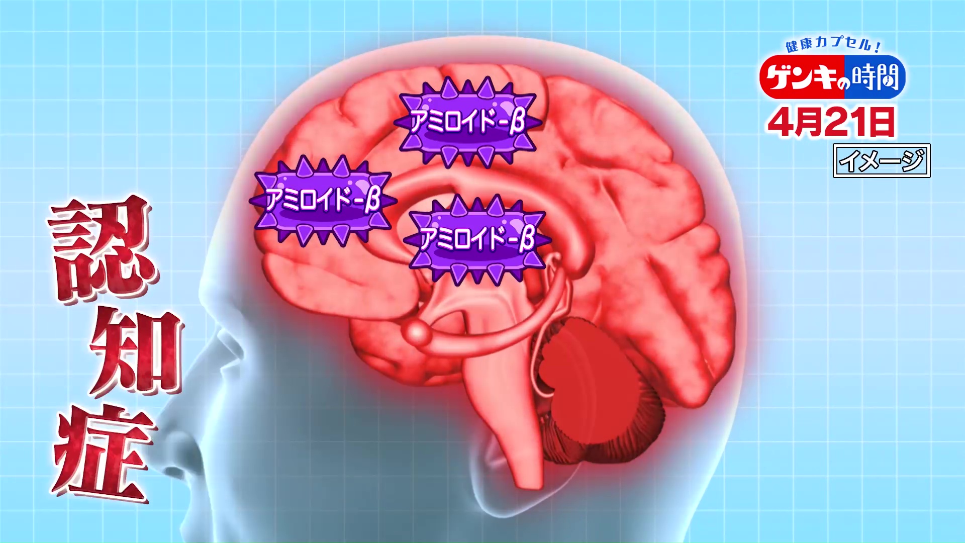 「認知症」進行を抑えられる病気に?…認知症治療も新たな時代!早期発見のポイント【医学博士 小野賢二郎】