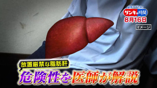 「脂肪肝」改善できる！？…注目の“改善入院”で学ぶ！脂肪肝の原因や改善法