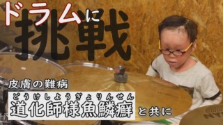 ピエロと呼ばれた息子がドラムに挑戦! 道化師様魚鱗癬の男の子 1歳の頃の映像も 定期配信型ドキュメンタリー 第11話