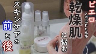 保湿は続けなければなりません 幼稚園に持参する5つの容器の中身は…道化師様魚鱗癬定期配信型ドキュメンタリー 第14話
