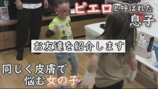 賀久くん、友達と遊ぶ。魚鱗癬と闘う女の子 定期配信型ドキュメンタリー「道化師様魚鱗癬」第20話