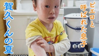 夏は苦手!“道化師様魚鱗癬” 産まれてすぐピエロと呼ばれた息子 CBCテレビ「チャント!」2021年9月8日 地上波OA版