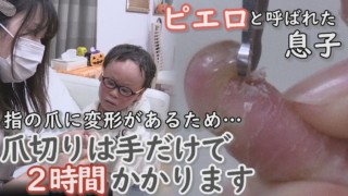 「痛い!」伸びた爪が皮膚に食い込む!?辛くても‥長時間ガマンの爪切り編…CBCテレビ 定期配信型 CBCドキュメンタリー「ピエロと呼ばれた息子」第31話