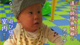 【皮膚の難病と生きる】歩き始めは2歳になる直前…スローペースの成長過程をお見せします!CBCテレビ定期配信型ドキュメンタリー「ピエロと呼ばれた息子」第34話