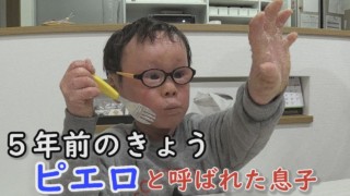賀久くん5歳になる。誕生日のケーキにも注意が必要です。難病「道化師様魚鱗癬」と向き合った日々。将来の期待と不安は…CBC テレビ定期配信型 ドキュメンタリー「ピエロと呼ばれた息子」第36話