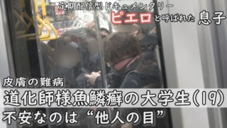 「私を見て笑う」「気持ち悪いと‥」“私の見た目”と“他人の目”‥19歳の女子大生も悩む CBCテレビ定期配信型ドキュメンタリー「ピエロと呼ばれた息子」第37話