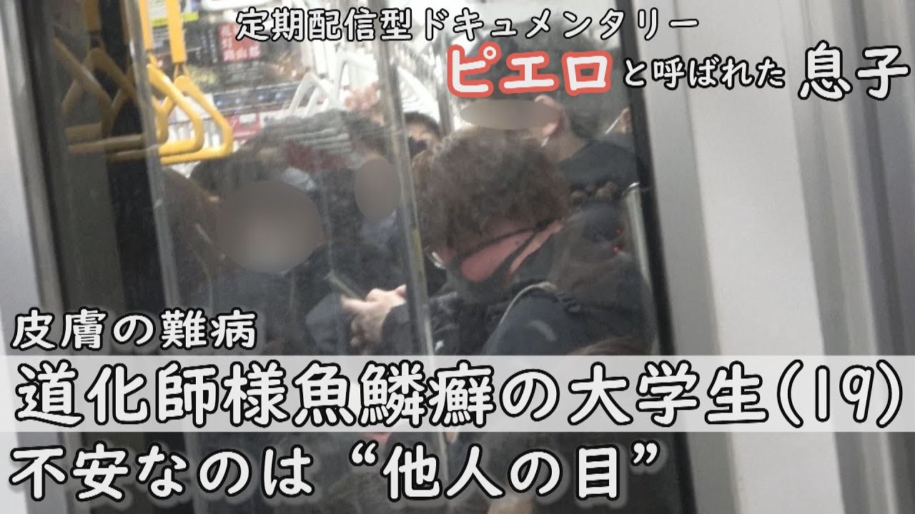 「私を見て笑う」「気持ち悪いと‥」“私の見た目”と“他人の目”‥１９歳の女子大生も悩む CBCテレビ定期配信型ドキュメンタリー「ピエロと呼ばれた息子」第３７話