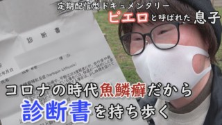 歩くだけで39℃の発熱…落ちる皮膚に悩んだ修学旅行とは!?魚鱗癬の大学生に密着 CBCテレビ定期配信型ドキュメンタリー「ピエロと呼ばれた息子」第39話