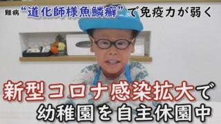 “風邪”で入院したことも…免疫力が弱いので“コロナ重症化”が心配です! CBCテレビ 定期配信型 ドキュメンタリー「ピエロと呼ばれた息子」第44話