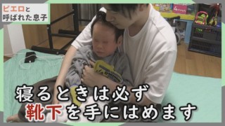 道化師様魚鱗癬は睡眠中が大変です!不眠不休‥母ちゃんのケアも…CBCテレビ定期配信型ドキュメンタリー「ピエロと呼ばれた息子」第48話