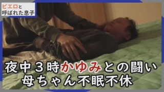 【深夜の撮影】睡眠中、全身のかゆみに襲われる賀久くん。出血も…CBCテレビ 定期配信型 ドキュメンタリー「ピエロと呼ばれた息子」第50話
