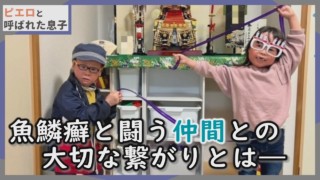 家族で京都へ!魚鱗癬の患者との交流はとても大切です…CBCテレビ定期配信型ドキュメンタリー「ピエロと呼ばれた息子」第52話