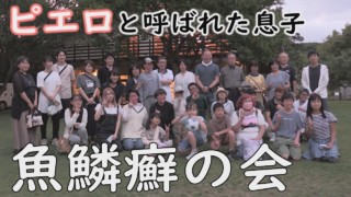 魚鱗癬でも病名バラバラ・症状さまざま…魚鱗癬の患者が集う年1回の交流会~CBCテレビ定期配信型ドキュメンタリー「ピエロと呼ばれた息子」第59話 #CBCドキュメンタリー