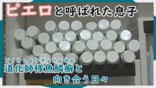 2年間で変わったことは…ワセリンを使っていた当時の様子~CBCテレビ定期配信型ドキュメンタリー「ピエロと呼ばれた息子」第63話