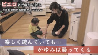 魚鱗癬は他人にうつりません!体のどこが一番かゆいのか…聞いてみると。~定期配信型ドキュメンタリー「ピエロと呼ばれた息子」第74話