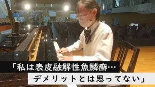 皮膚の難病と闘う高校生が“Official髭男dism”の曲を生演奏~定期配信型ドキュメンタリー「ピエロと呼ばれた息子」第76話