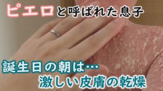 魚鱗癬はうつらない。賀久くんと両親が闘った6年間の軌跡~定期配信型ドキュメンタリー「ピエロと呼ばれた息子」第80話