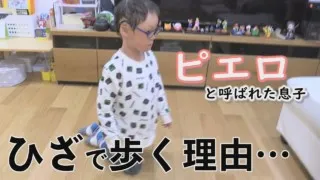車いすの使用も検討…これも魚鱗癬の症状の1つです~定期配信型ドキュメンタリー「ピエロと呼ばれた息子」第83話