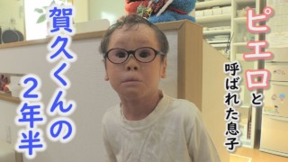 2022年12月17日地上波OA版 “道化師様魚鱗癬” CBCテレビ「報道のチカラ」 産まれてすぐピエロと呼ばれた息子