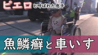 皮膚の難病で歩行困難に…足裏の皮膚はどうなっているのか…~定期配信型ドキュメンタリー「ピエロと呼ばれた息子」第89話