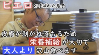 回転寿司で山積みの皿!いったい何皿食べたの?魚鱗癬は栄養補給が大切です…~定期配信型ドキュメンタリー「ピエロと呼ばれた息子」第90話