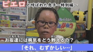 【小学生も分かる!】皮膚の難病、道化師様魚鱗癬はどんな病気?…~定期配信型ドキュメンタリー「ピエロと呼ばれた息子」