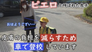 母ちゃんから見た魚鱗癬と闘う賀久くん(小1)は…~定期配信型ドキュメンタリー「ピエロと呼ばれた息子」第98話