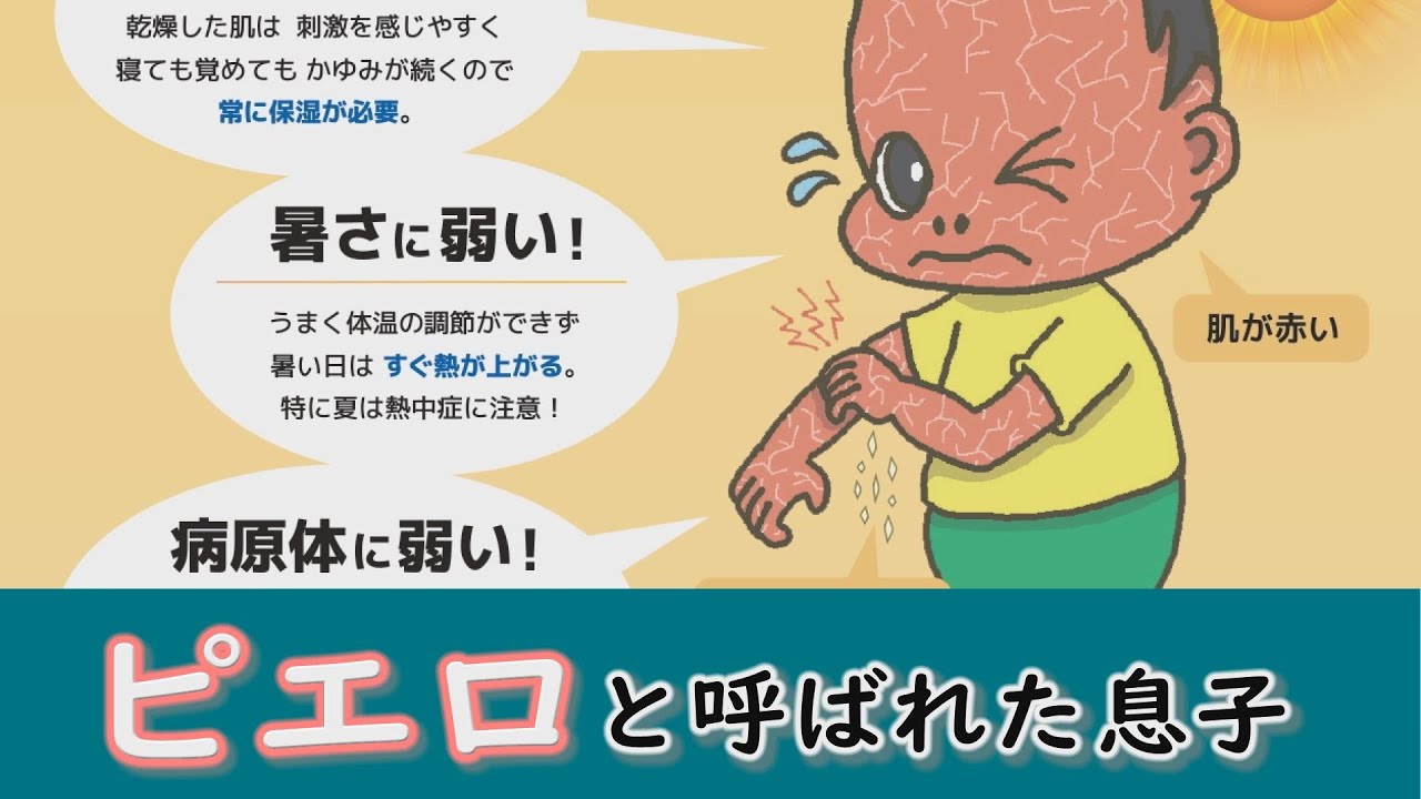 家族で皮膚の難病と闘っています…すべては息子、そして患者のために～　配信型ドキュメンタリー「ピエロと呼ばれた息子」第105話