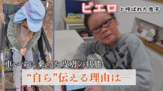 皮膚の状態を自ら言葉で…小1男児の伝えたいこと‥配信型ドキュメンタリー「ピエロと呼ばれた息子」第118話