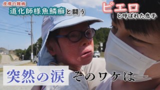 痛みに耐えられなかった賀久くん…大丈夫?家族で出かけた春の“三重旅“~配信型ドキュメンタリー「ピエロと呼ばれた息子」第121話