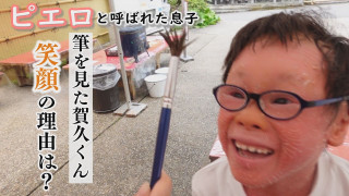 魚鱗癬と闘う一家の日常生活!家族で京都へ行った時は…?~配信型ドキュメンタリー「ピエロと呼ばれた息子」第127話