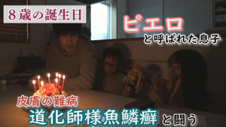皮膚の難病と闘う~足の痛みと向き合う中、家族で迎えた誕生日~配信型ドキュメンタリー「ピエロと呼ばれた息子」第133話