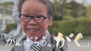 【長編】ピエロと呼ばれた息子~取材5年 皮膚の難病・道化師様魚鱗癬~2025年3月30日地上波放送
