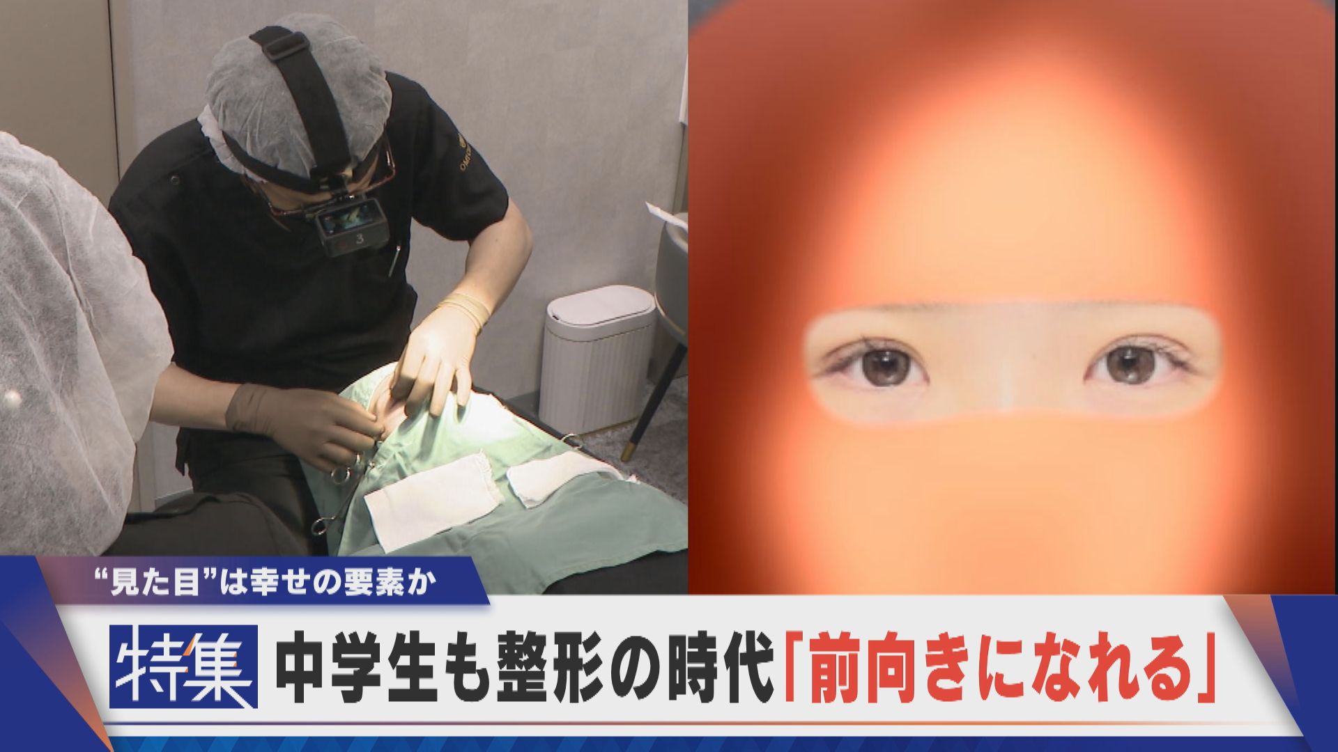 【特集】「前を向いて歩ける」二重まぶたに… 中高生も整形を…“見た目”で前向きに