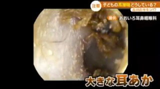 耳掃除は家でやってはダメ！？正しい耳の中のケアと耳垢の知識